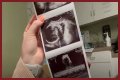 Counting On Alum Joy-Anna Forsyth Updates At 33 Weeks Pregnant
